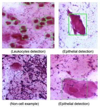 Dataset containing 8 Gram-stain slide images. Images are captured using a 2.5x objective (low-magnification).