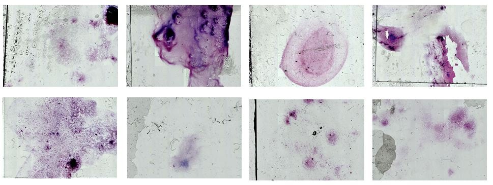 Dataset containing 8 Gram-stain slide images. Images are captured using a 2.5x objective (low-magnification).